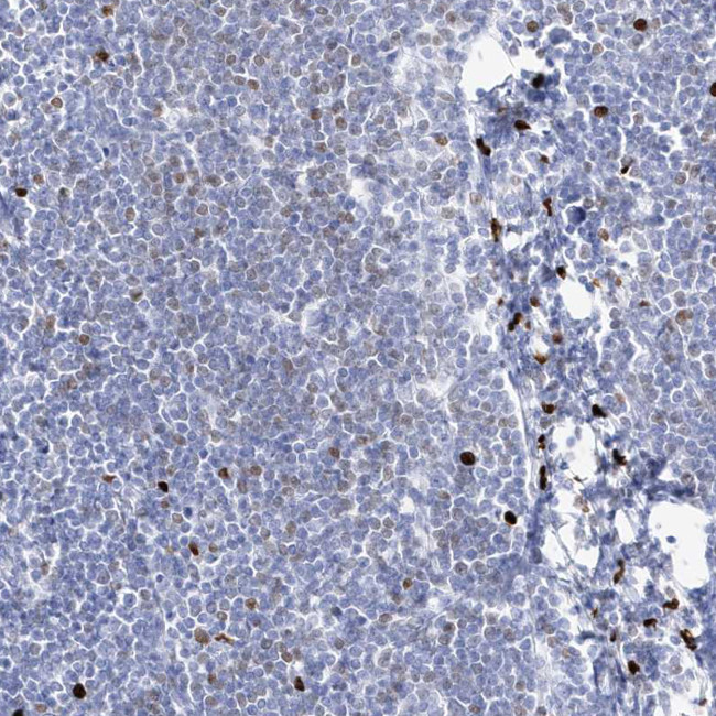 Myeloid Specific Antigen Antibody in Immunohistochemistry (Paraffin) (IHC (P))