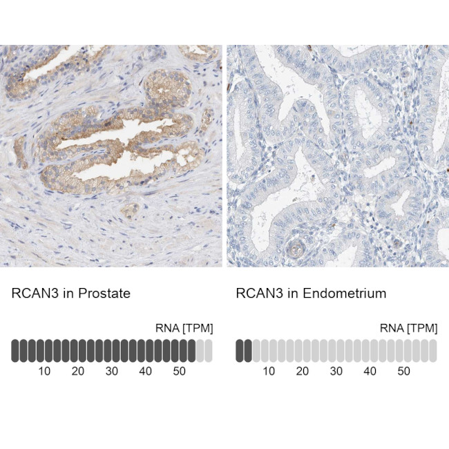 RCAN3 Antibody in Immunohistochemistry (IHC)