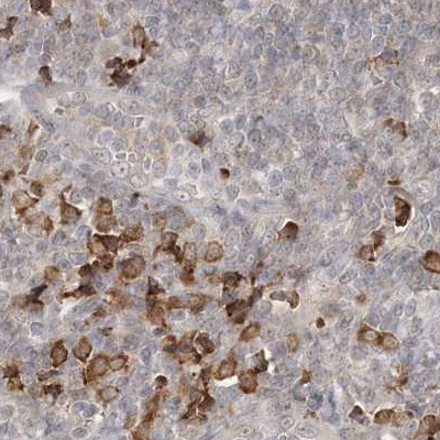 C13orf7 Antibody in Immunohistochemistry (IHC)