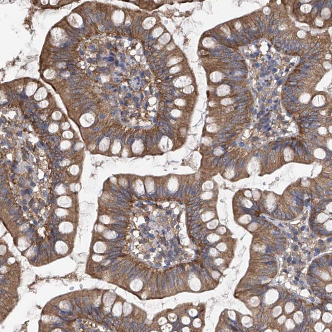 CHPF Antibody in Immunohistochemistry (Paraffin) (IHC (P))