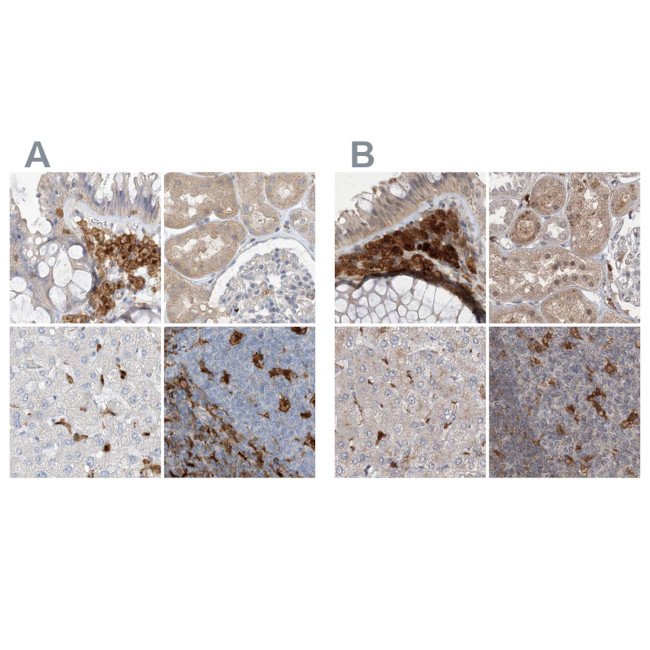 NAGK Antibody in Immunohistochemistry (IHC)