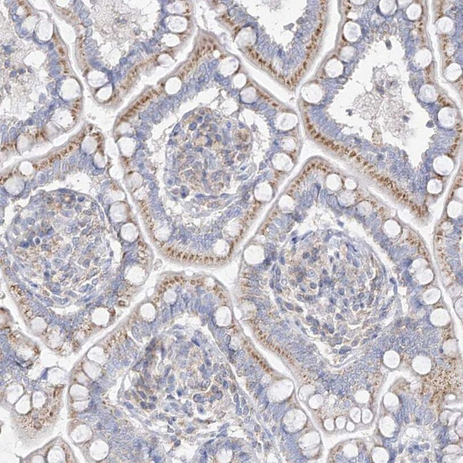 RASA2 Antibody in Immunohistochemistry (IHC)