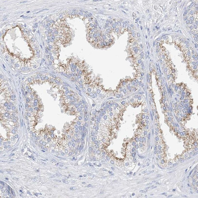 RASA2 Antibody in Immunohistochemistry (IHC)