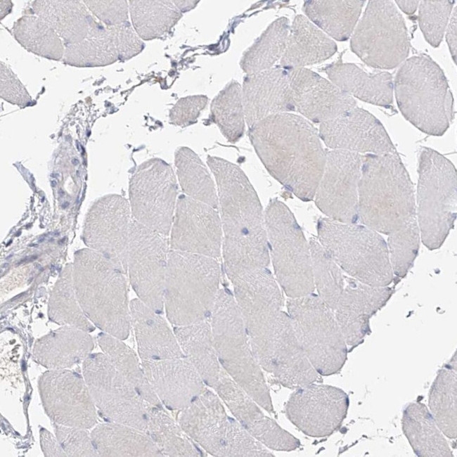 RASA2 Antibody in Immunohistochemistry (IHC)