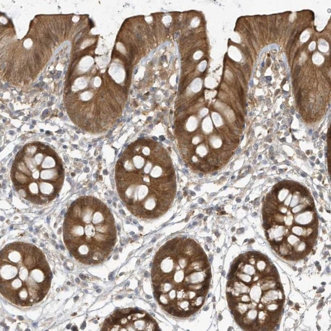 HNMT Antibody in Immunohistochemistry (IHC)