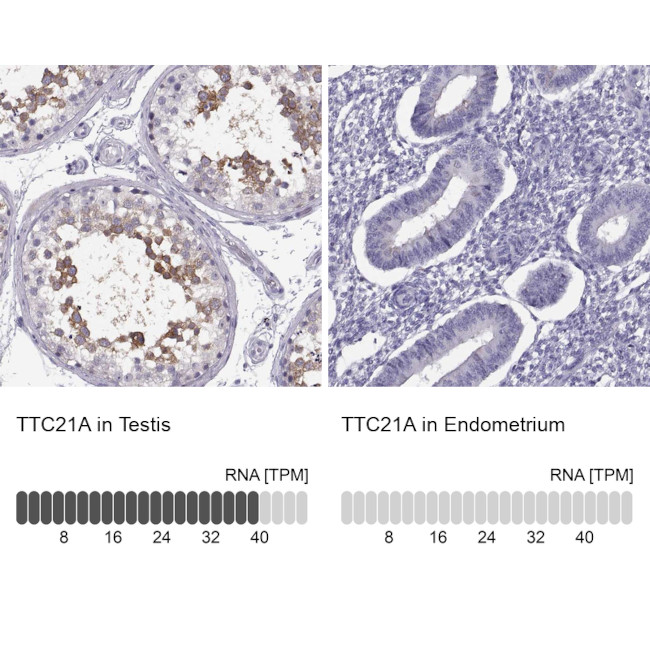 TTC21A Antibody in Immunohistochemistry (IHC)