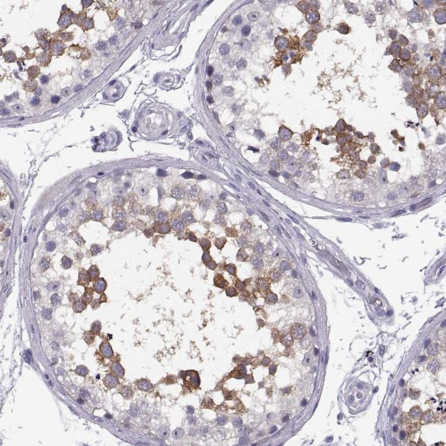 TTC21A Antibody in Immunohistochemistry (IHC)