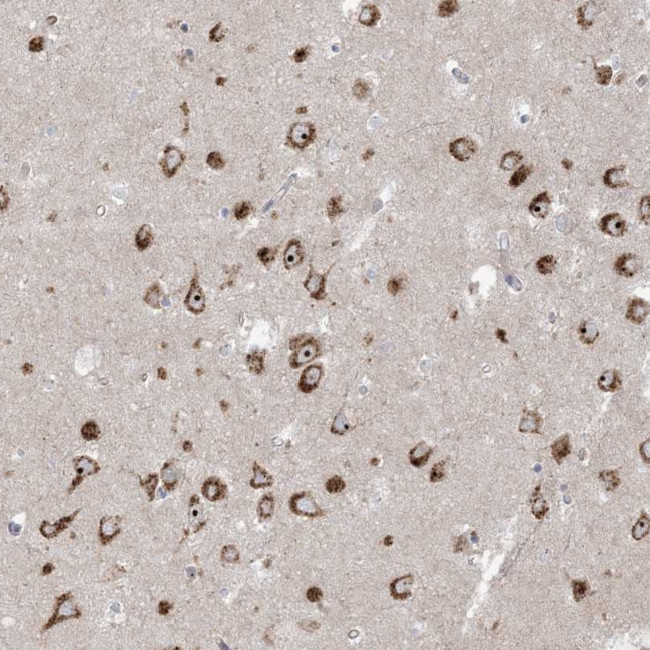 MARS2 Antibody in Immunohistochemistry (Paraffin) (IHC (P))