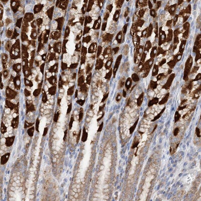 TTC32 Antibody in Immunohistochemistry (IHC)