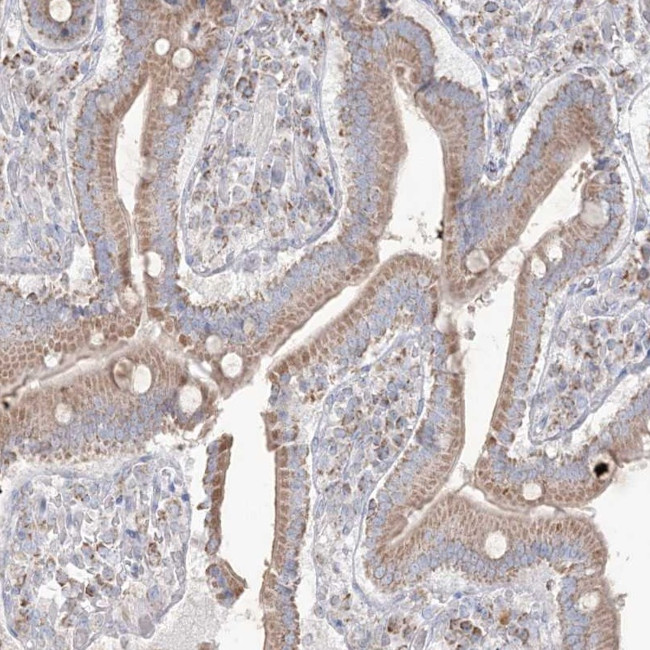 KCTD6 Antibody in Immunohistochemistry (Paraffin) (IHC (P))