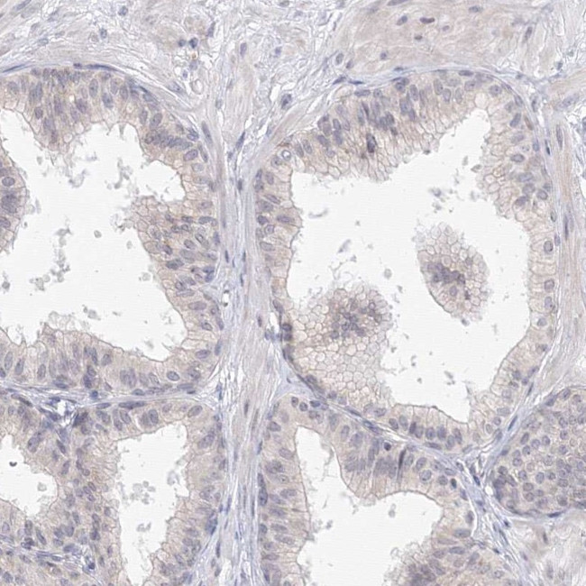 SLC7A7 Antibody in Immunohistochemistry (IHC)