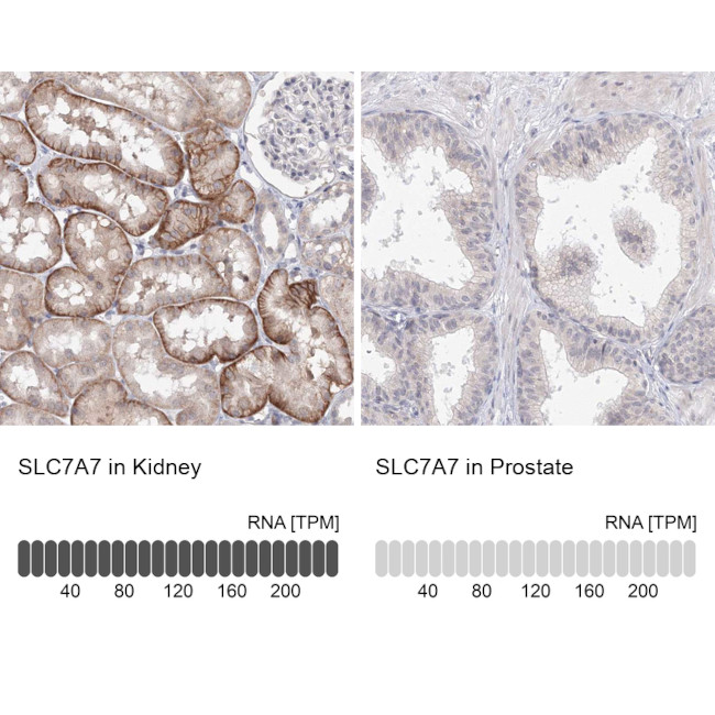 SLC7A7 Antibody