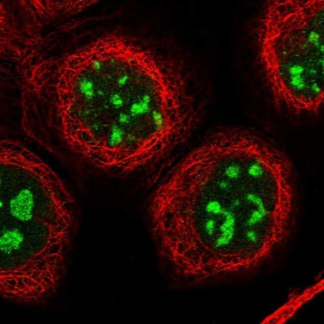 CENPH Antibody in Immunocytochemistry (ICC/IF)