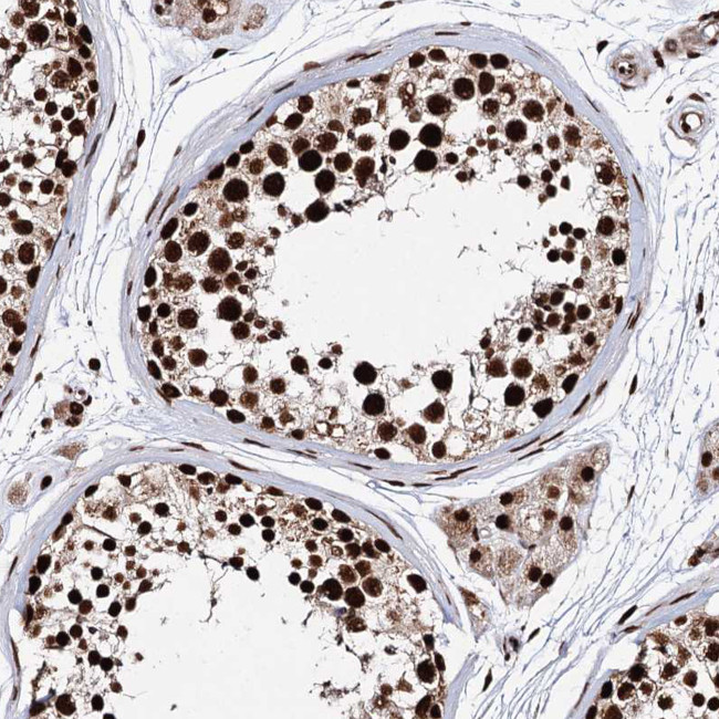 MATR3 Antibody in Immunohistochemistry (Paraffin) (IHC (P))