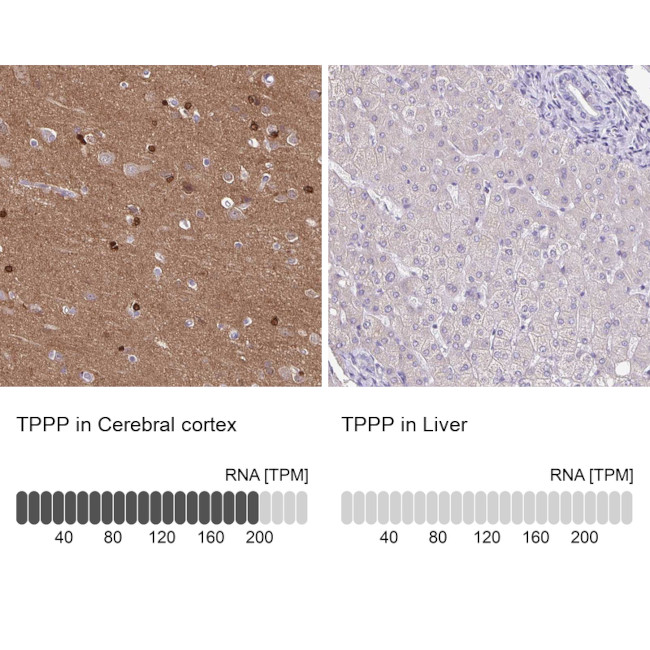 TPPP Antibody in Immunohistochemistry (IHC)