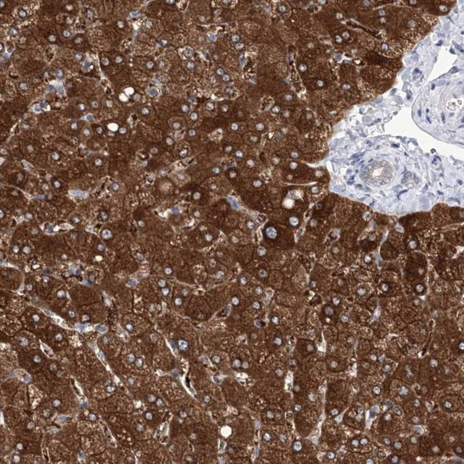 UGDH Antibody in Immunohistochemistry (IHC)