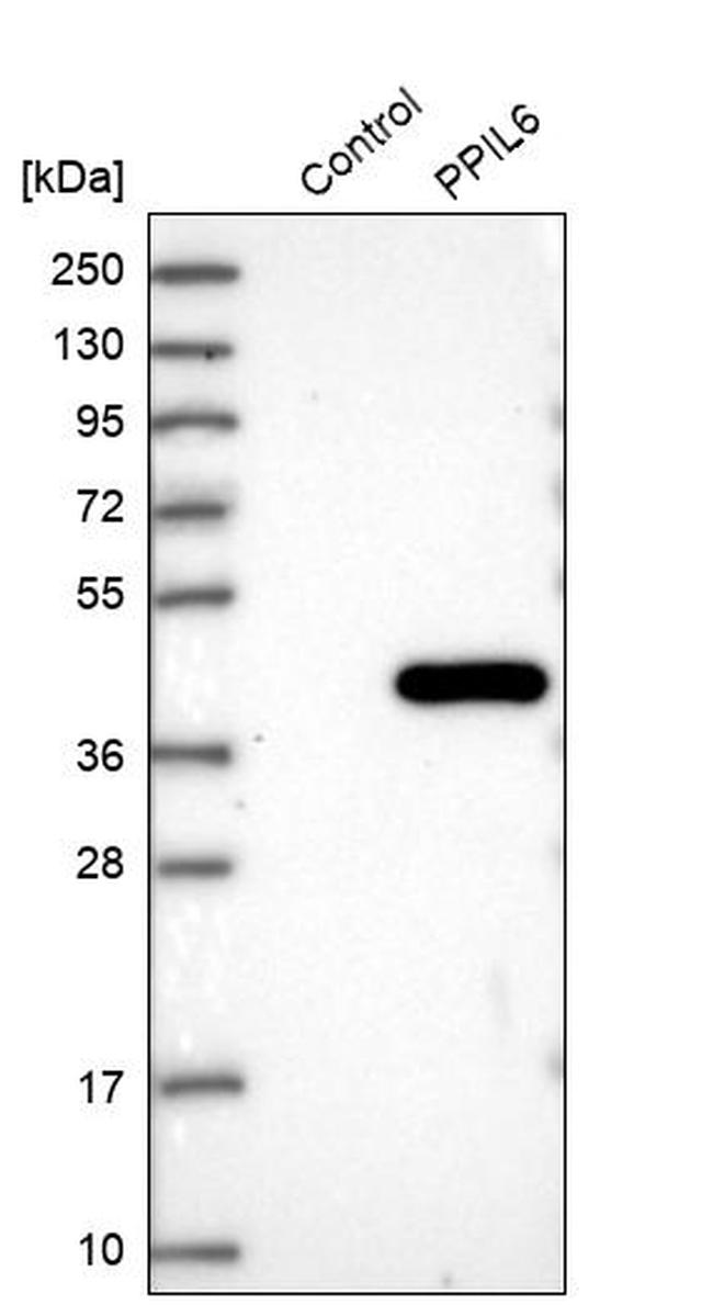 PPIL6 Antibody in Western Blot (WB)