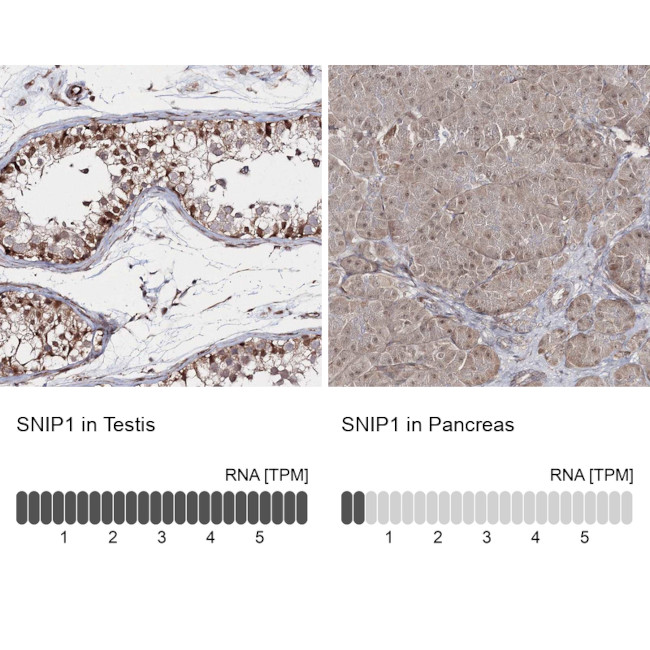 SNIP1 Antibody in Immunohistochemistry (IHC)