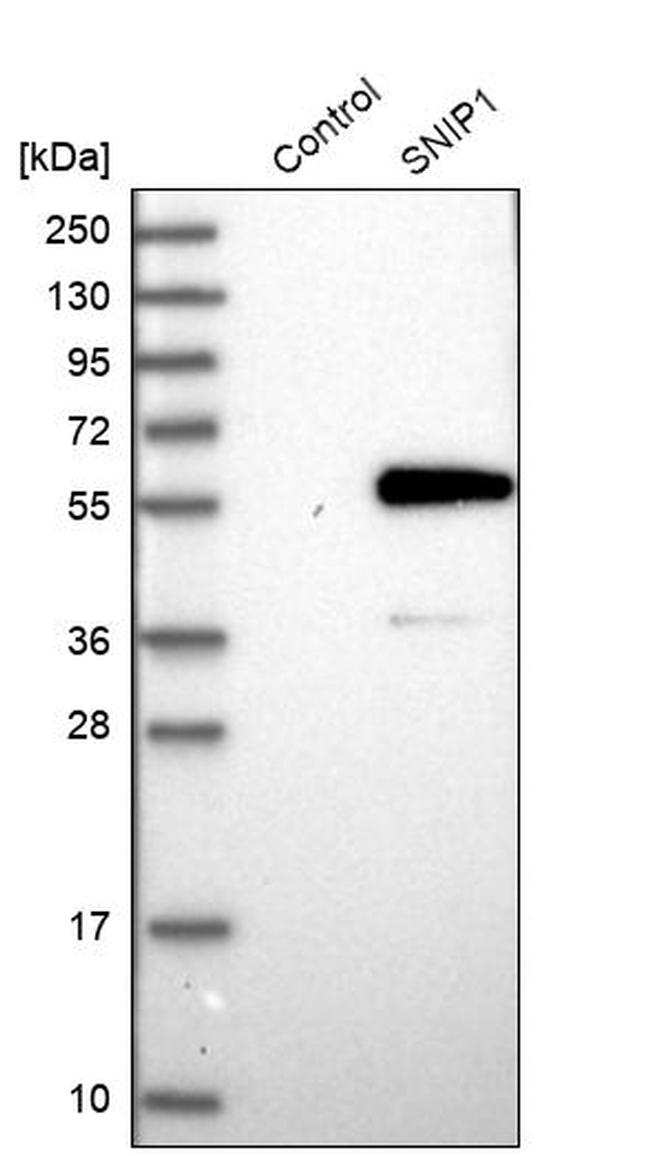 SNIP1 Antibody in Western Blot (WB)