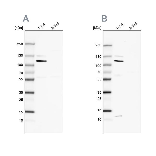 MCC Antibody in Western Blot (WB)