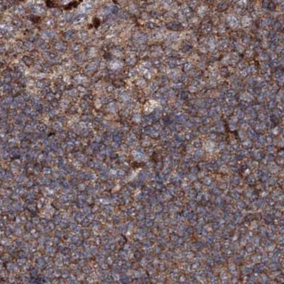 DDO Antibody in Immunohistochemistry (IHC)