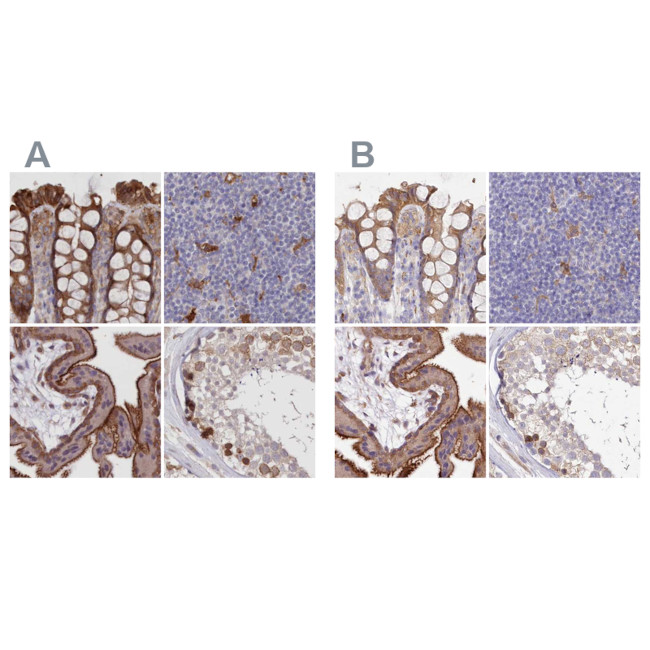 FCHO2 Antibody in Immunohistochemistry (IHC)