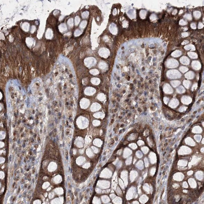 SERINC5 Antibody in Immunohistochemistry (IHC)