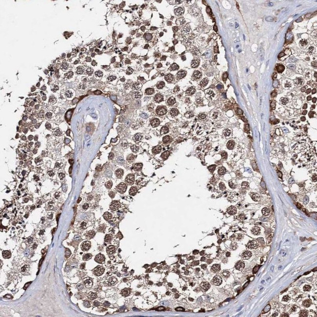 TTC40 Antibody in Immunohistochemistry (IHC)