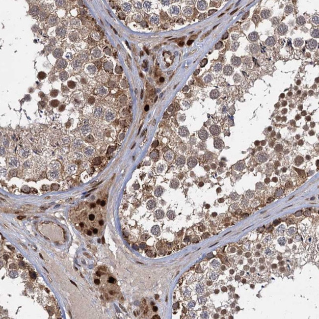 GAL3ST4 Antibody in Immunohistochemistry (Paraffin) (IHC (P))