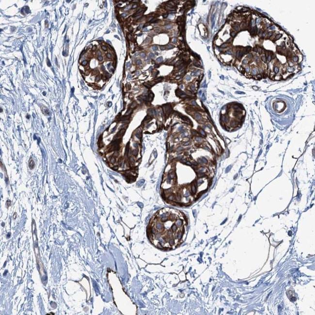 CALCOCO1 Antibody in Immunohistochemistry (Paraffin) (IHC (P))