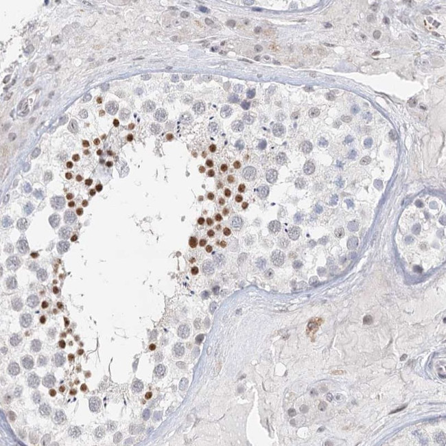 C6orf222 Antibody in Immunohistochemistry (Paraffin) (IHC (P))