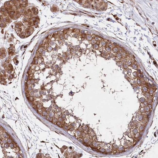 MTPAP Antibody in Immunohistochemistry (Paraffin) (IHC (P))