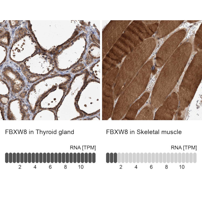 FBXW8 Antibody in Immunohistochemistry (IHC)