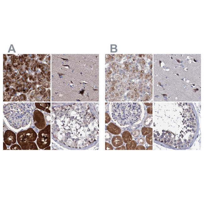 CLPB Antibody in Immunohistochemistry (IHC)