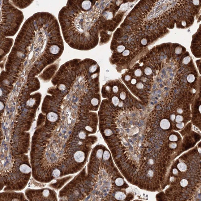 DYNC2H1 Antibody in Immunohistochemistry (Paraffin) (IHC (P))