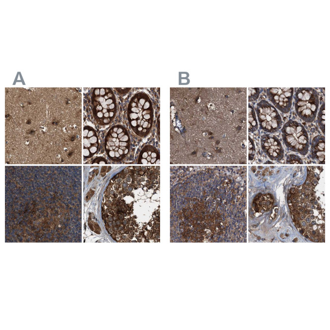 PEX5 Antibody in Immunohistochemistry (IHC)