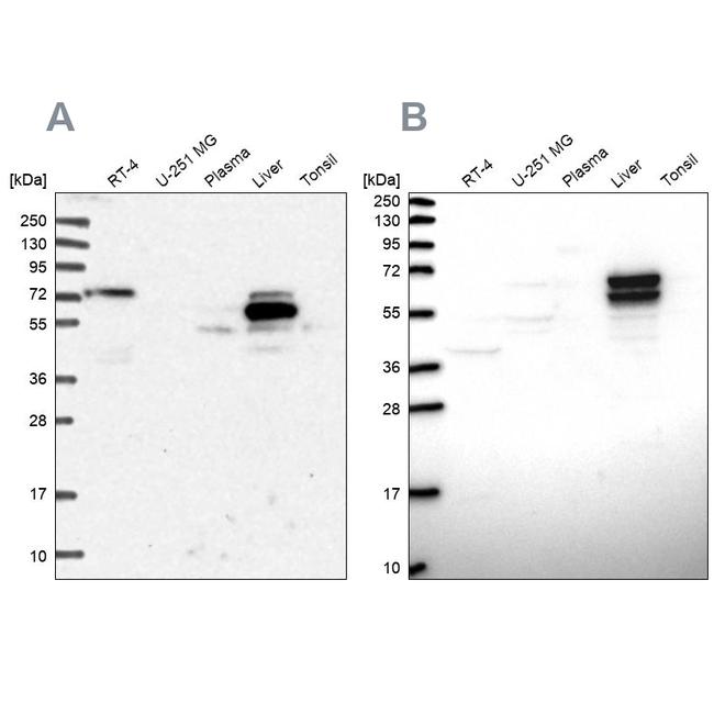 ACSS3 Antibody in Western Blot (WB)