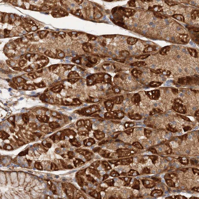 CSAD Antibody in Immunohistochemistry (Paraffin) (IHC (P))