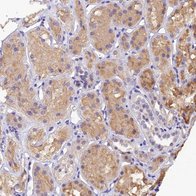 DGKH Antibody in Immunohistochemistry (Paraffin) (IHC (P))