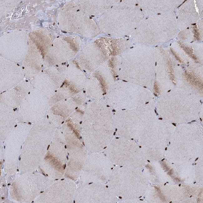 RPUSD4 Antibody in Immunohistochemistry (IHC)