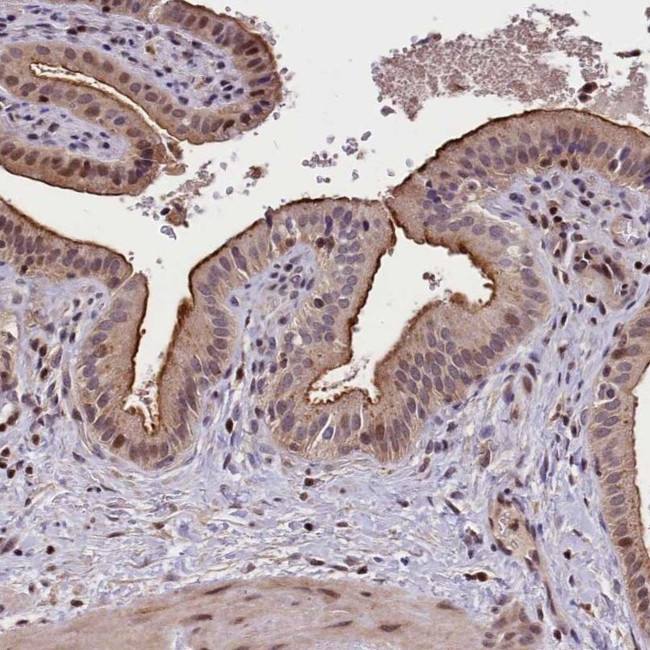 ATG101 Antibody in Immunohistochemistry (IHC)