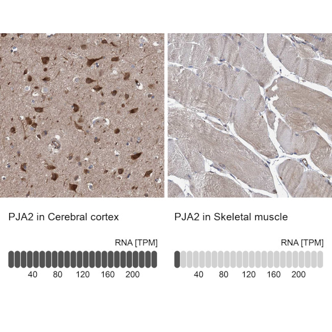 PJA2 Antibody in Immunohistochemistry (IHC)