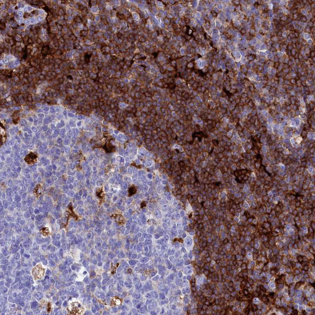 PLAC8 Antibody in Immunohistochemistry (IHC)