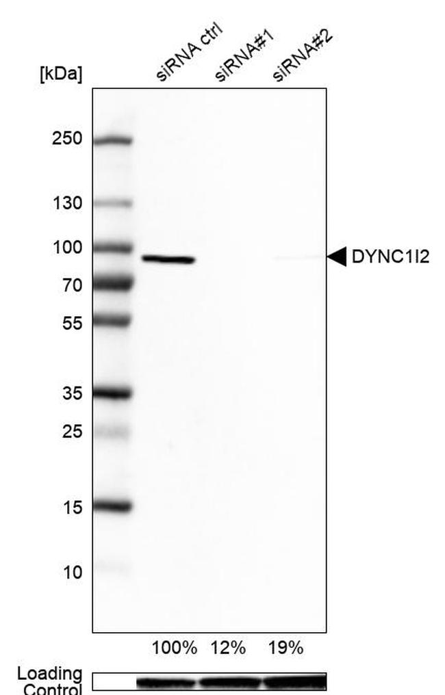 DYNC1I2 Antibody in Western Blot (WB)