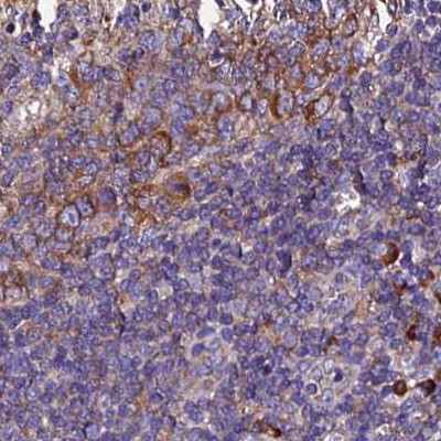 EEF1G Antibody in Immunohistochemistry (IHC)