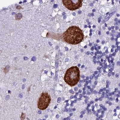 EEF1G Antibody in Immunohistochemistry (IHC)