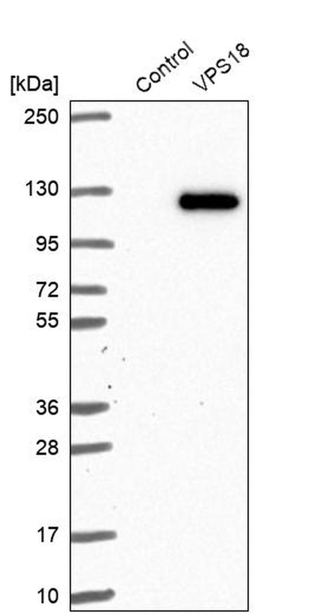 VPS18 Antibody in Western Blot (WB)