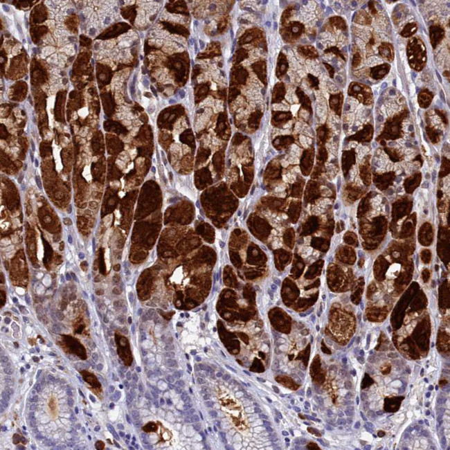 GIF Antibody in Immunohistochemistry (IHC)