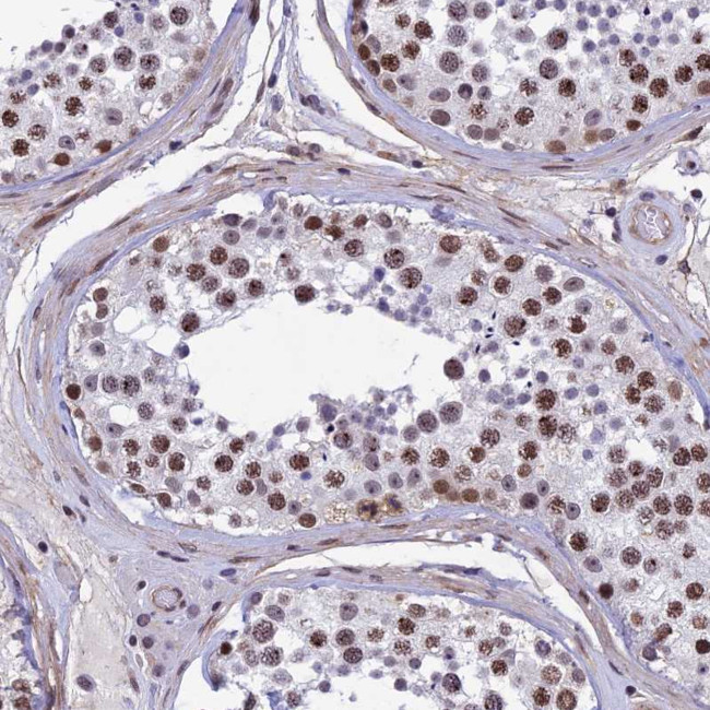 NIPBL Antibody in Immunohistochemistry (Paraffin) (IHC (P))