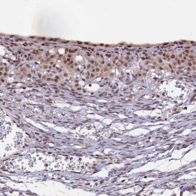 POLR2C Antibody in Immunohistochemistry (IHC)